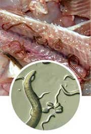 Food and water as a route of parasite contamination